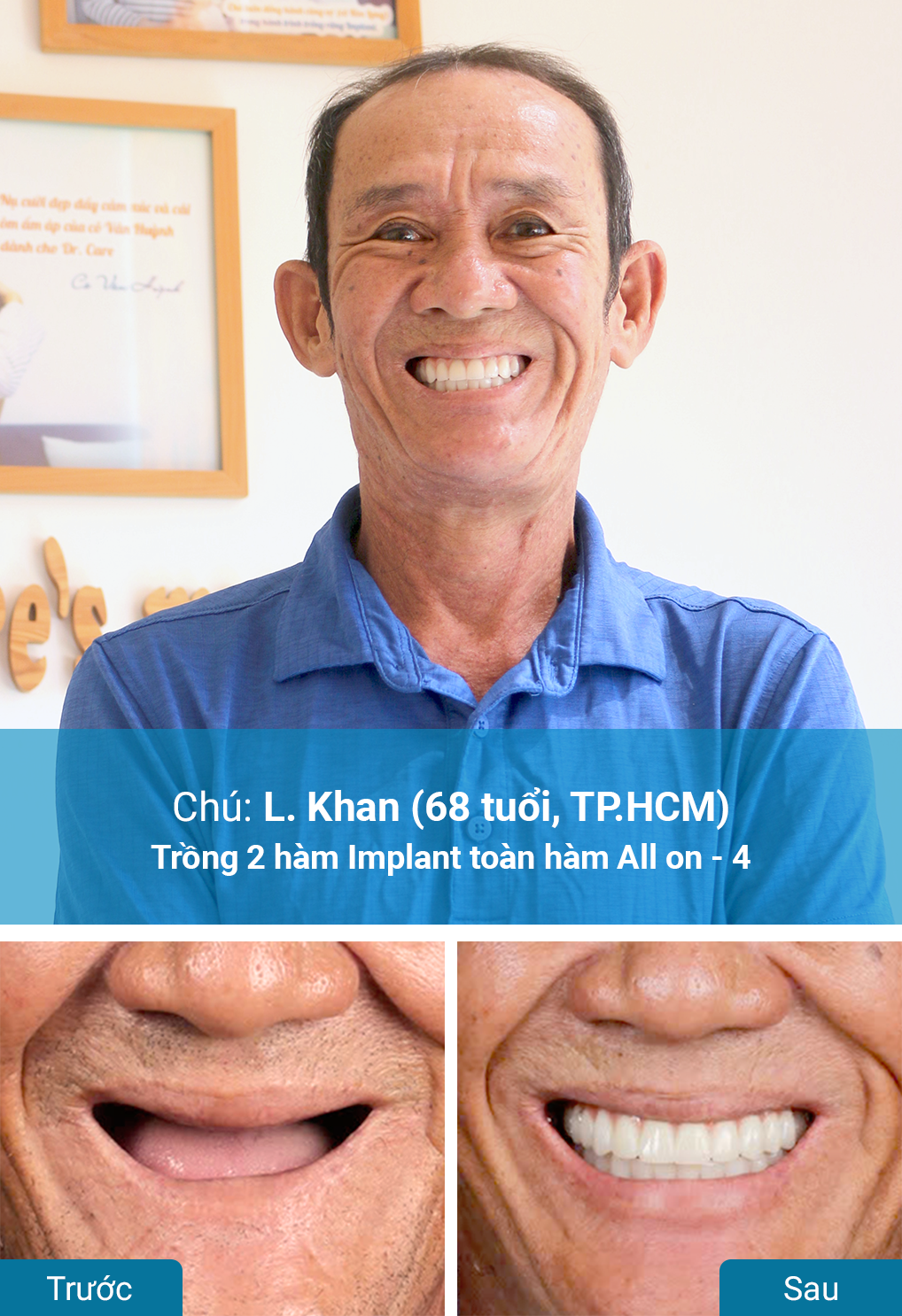 Khách hàng trồng răng Implant tại nha khoa Dr. Care