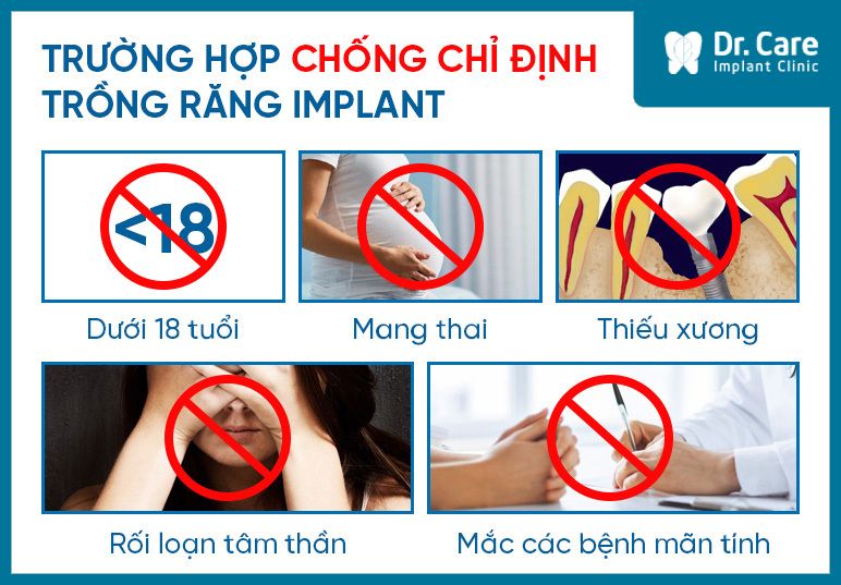 chống chỉ định cấy ghép Implant