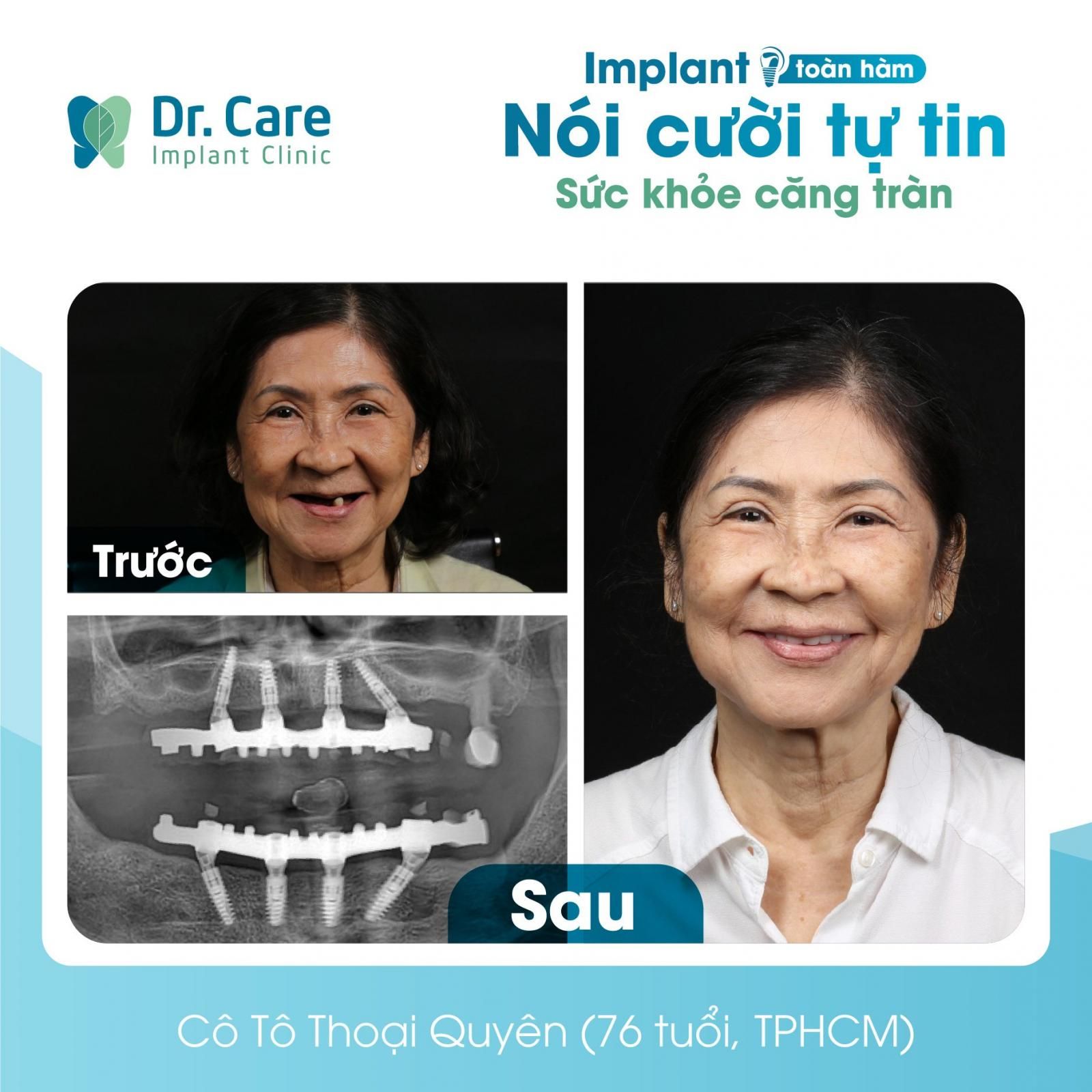 Ảnh hưởng tính thẩm mỹ