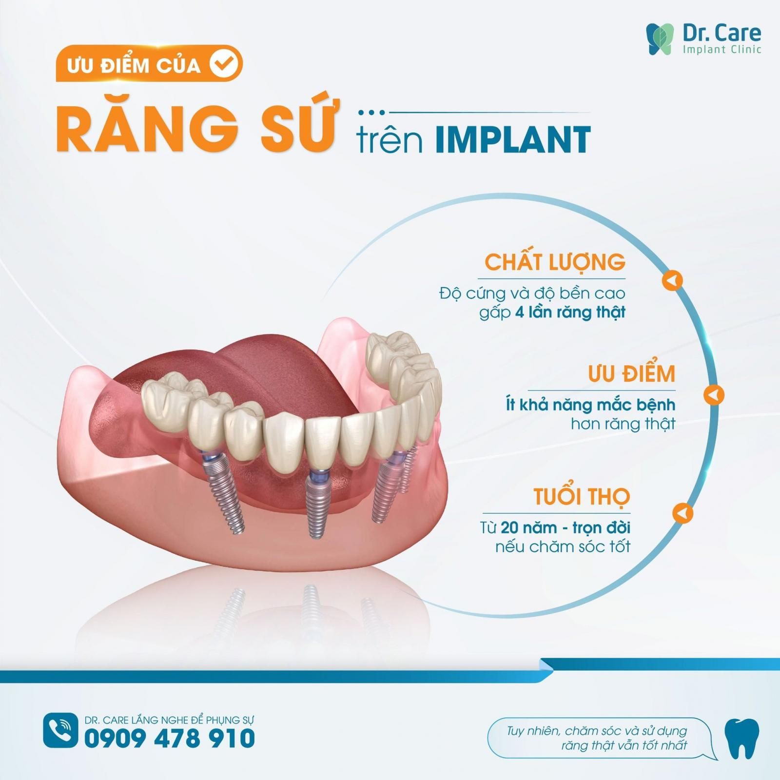 Phục hình răng sứ trên Implant giúp ngăn ngừa tình trạng tiêu xương hàm