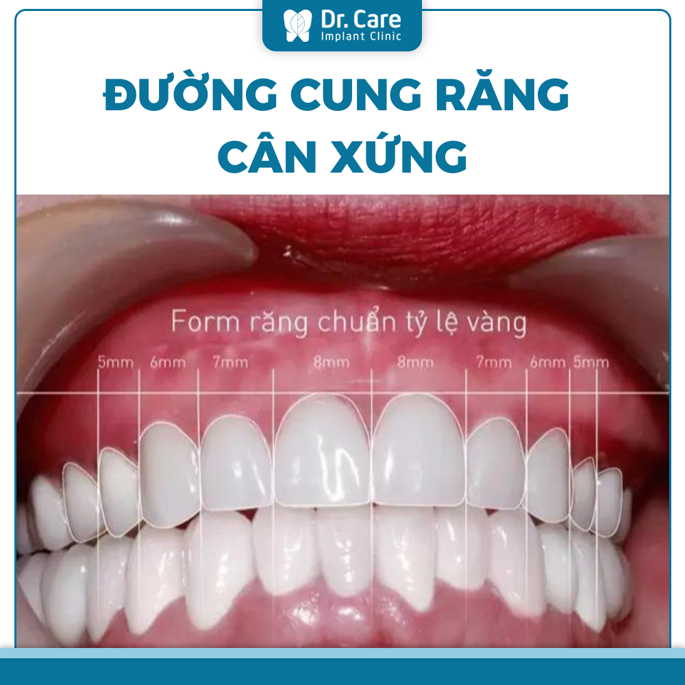 Tiêu chí đánh giá hàm răng đẹp chuẩn Y khoa