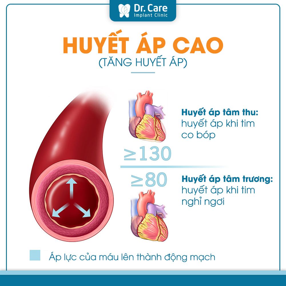 Việc giảm thiểu lượng muối đưa vào cơ thể trong các bữa ăn giúp phòng ngừa tình trạng cao huyết áp