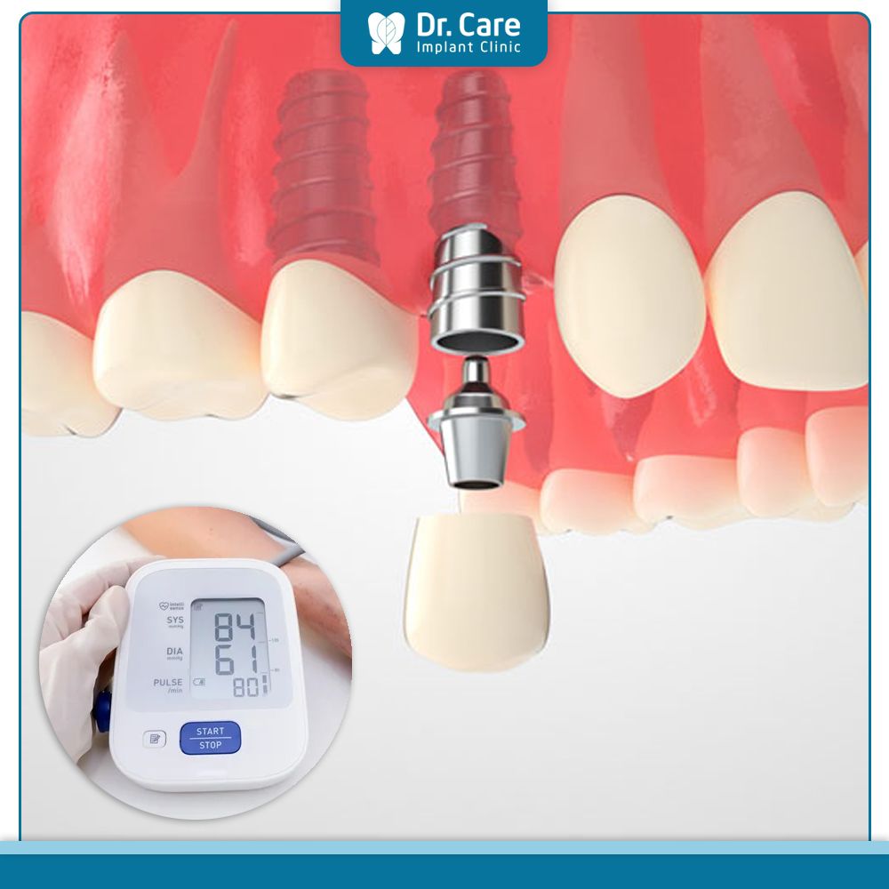 Trồng răng implant cho người huyết áp thấp