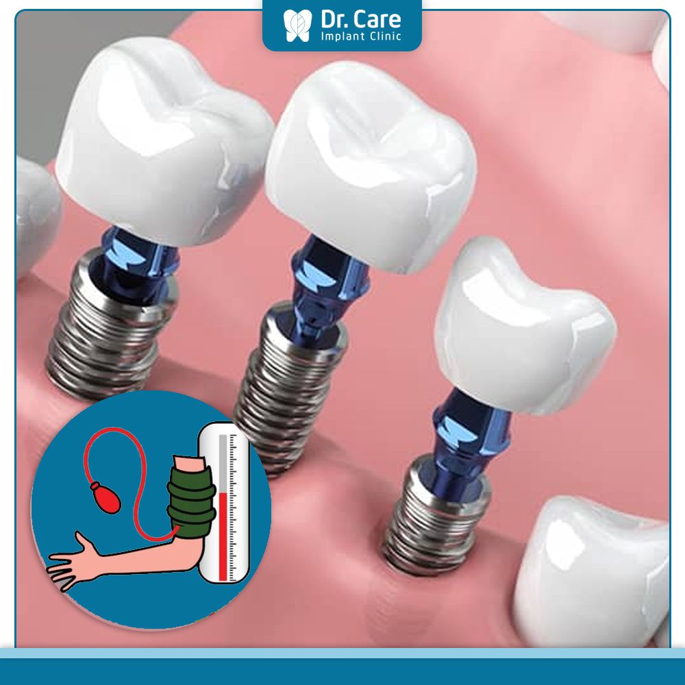 Trồng răng Implant cho người cao huyết áp