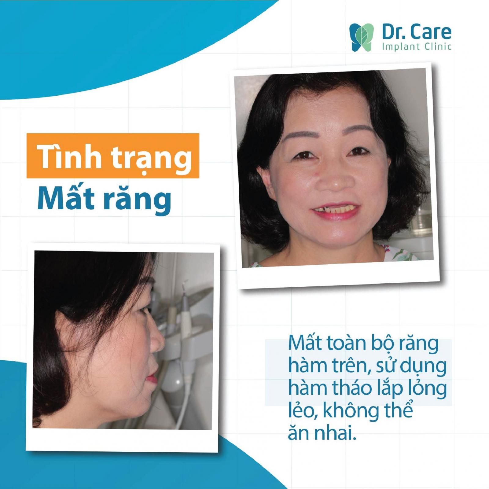 dr care chị cẩm linh