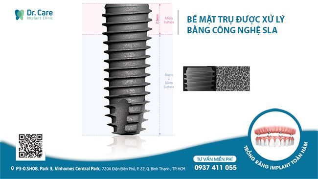 Công nghệ thổi vi cát SLA tạo nên một lớp màng sinh học tự nhiên cho trụ Implant Dio Hàn Quốc, có tác dụng đẩy nhanh quá trình tích hợp xương