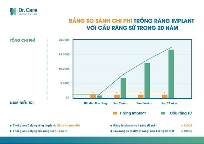 So sánh giá làm cầu răng sứ và răng Implant