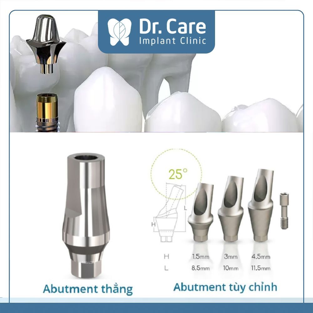 Abutment Implant theo hình dạng bao gồm: Abutment thẳng và Abutment tùy chỉnh