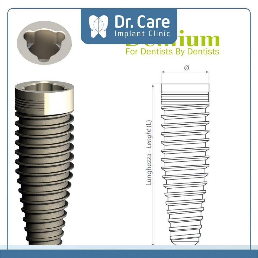 Implant Dentium có độ bền ổn định, khả năng chống gãy cao, kháng mòn hóa học tốt