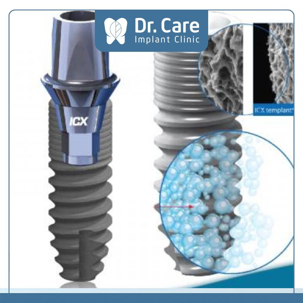 Trụ Implant ICX-ACTIVE LIQUID (Đức) có bề mặt cấu trúc vi mô, ưa nước. Bề mặt mô cấy được bảo quản trong nước muối vô trùng