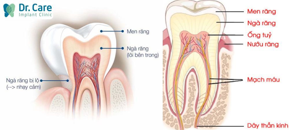 Thành phần của răng bao gồm men răng, ngà răng, tủy răng