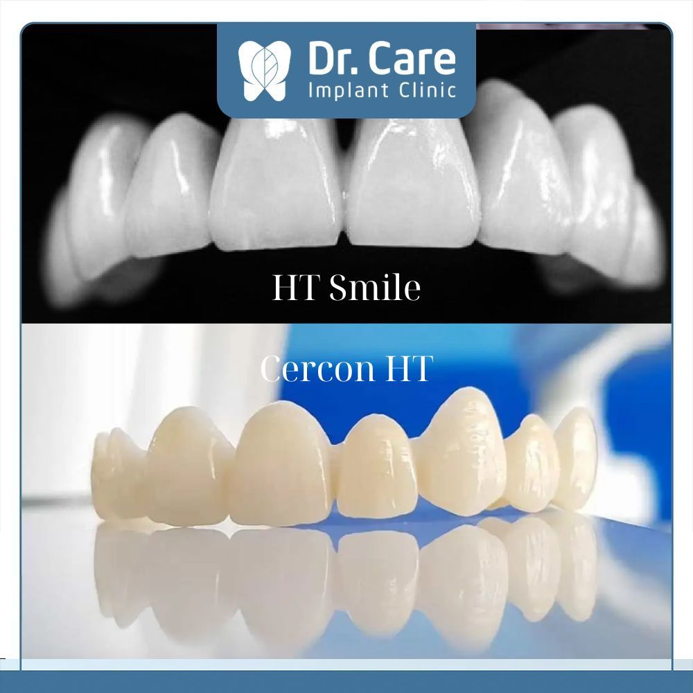 Răng sứ HT Smile có tốt không? Đây là điều mà nhiều Cô Chú, Anh Chị trước khi lựa chọn dòng răng sứ này băn khoăn. Trên thực tế, dòng răng sứ này tốt và phù hợp với nhiều trường hợp khác nhau, mang lại kết quả phục hình tốt. Cụ thể bên dưới là các đặc điểm thể hiện chất lượng của HT Smile. 