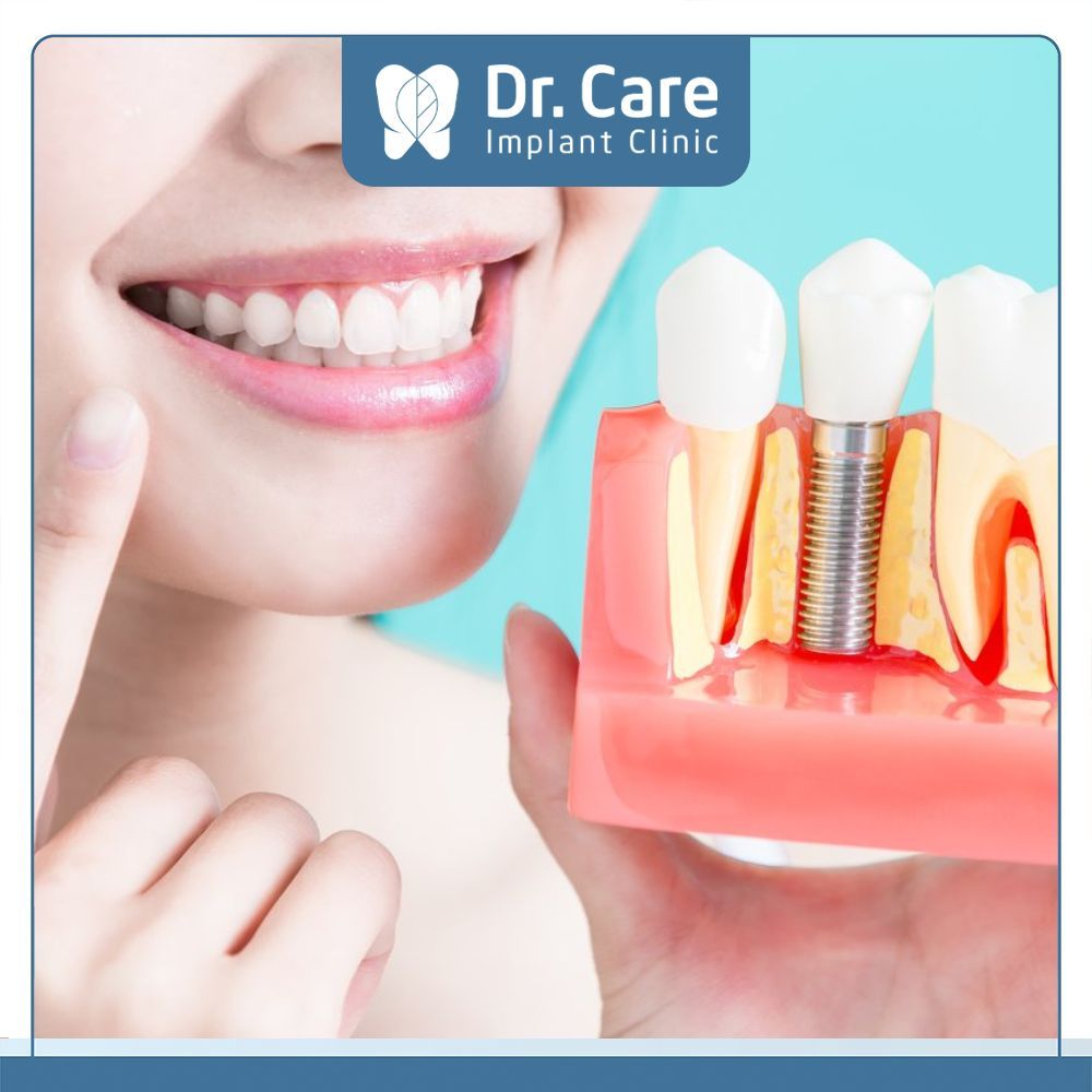 Trồng răng Implant bị sưng trong bao lâu?