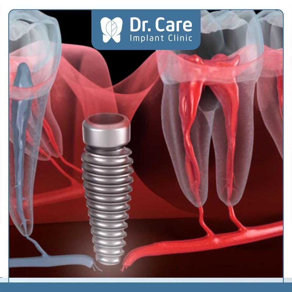 Tổn thương đến dây thần kinh và các mô