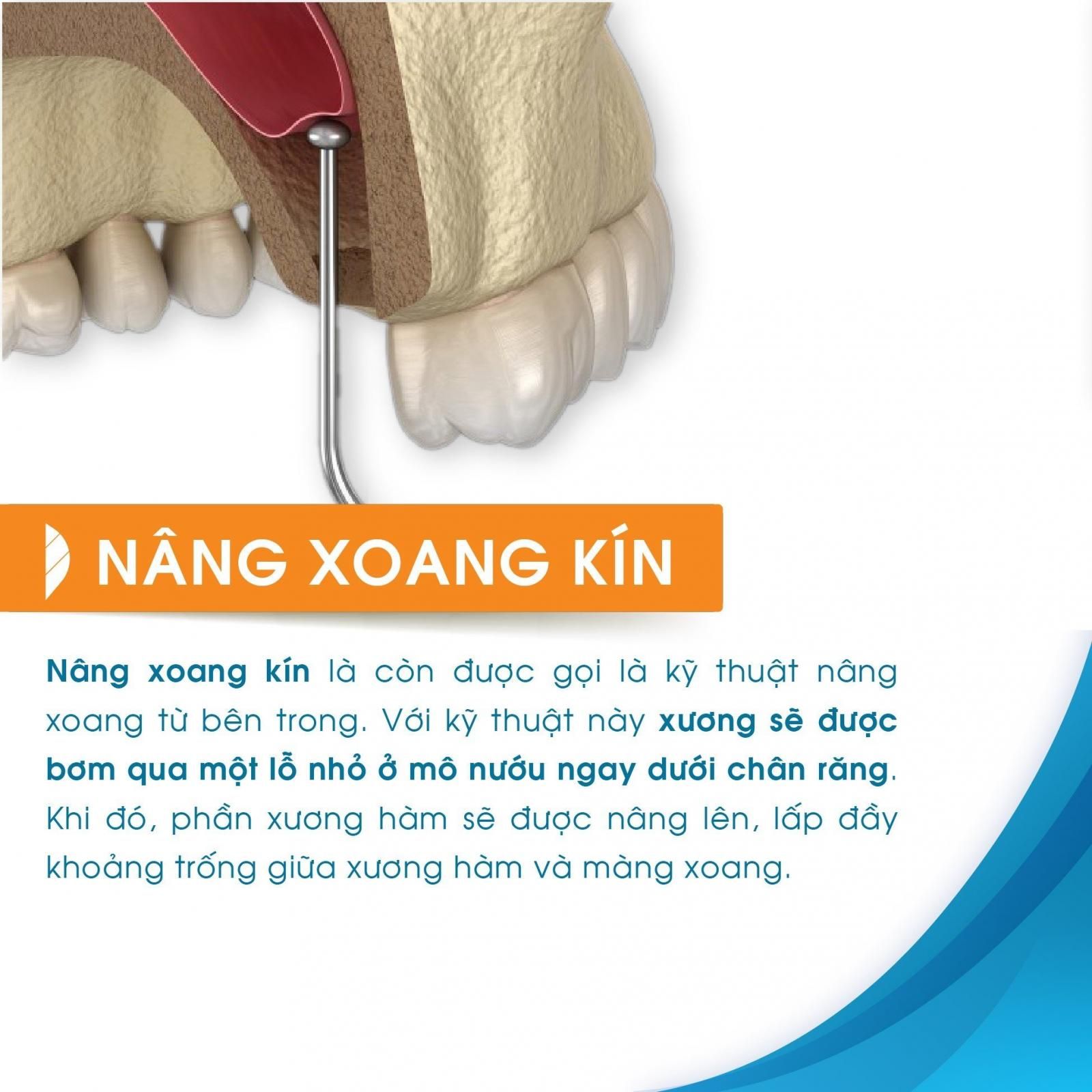 7. Các thành ngữ và cụm từ liên quan đến 