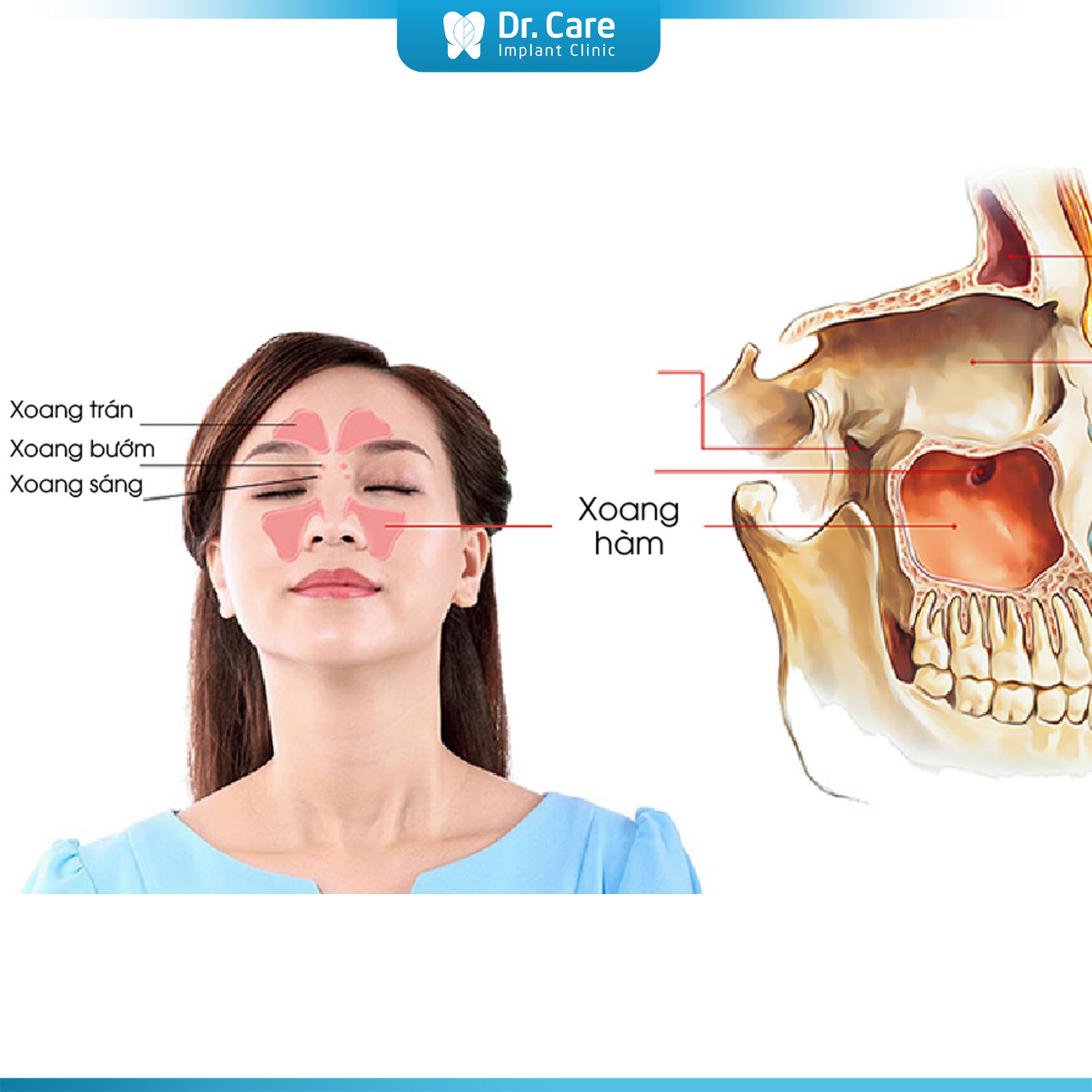 Đối tượng nào có thể thực hiện nâng xoang?