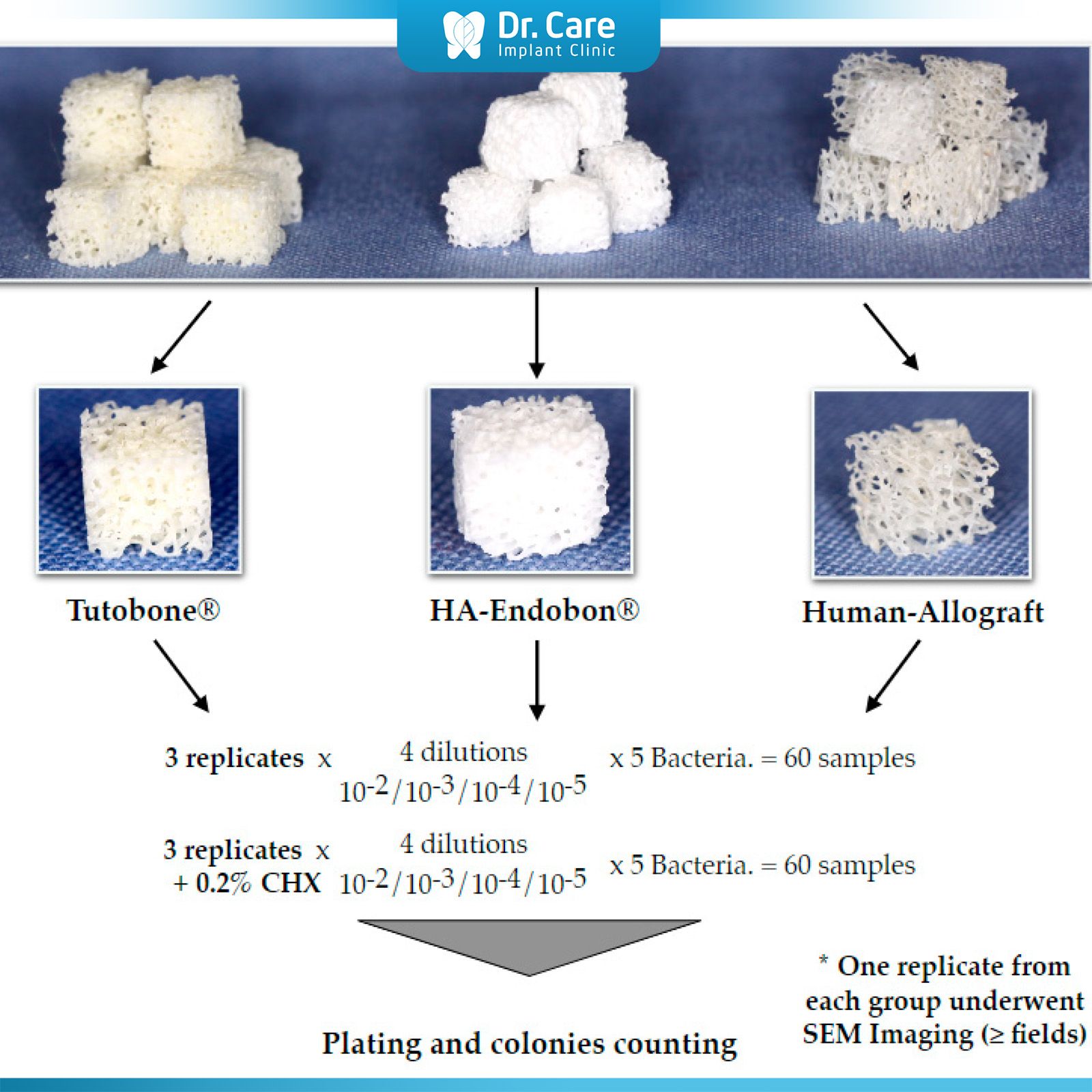 Vật liệu tổng hợp (Alloplastic)