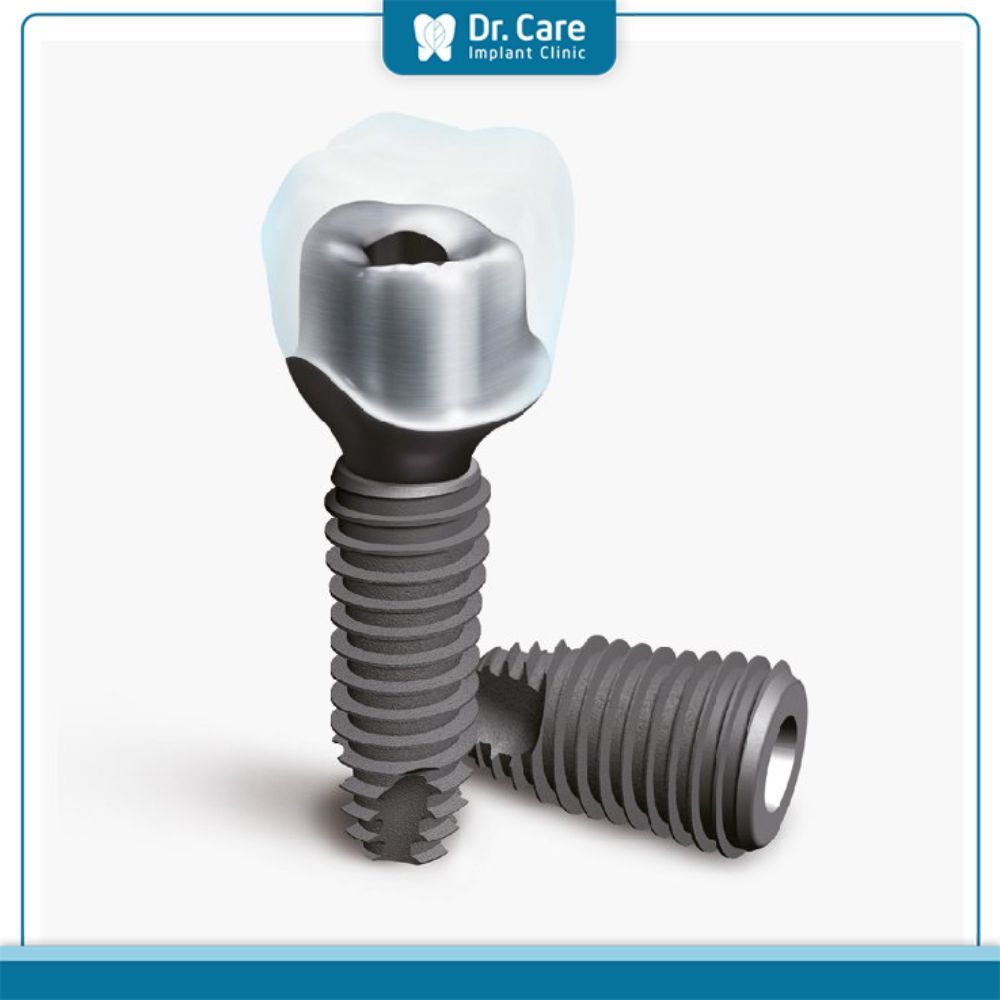 Các loại trụ Implant có cùng phân khúc với Implant Osstem Hàn Quốc