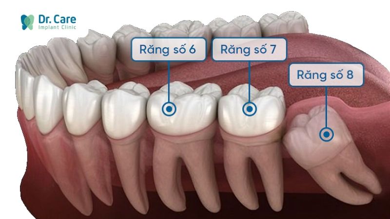 Răng số 7 là gì?