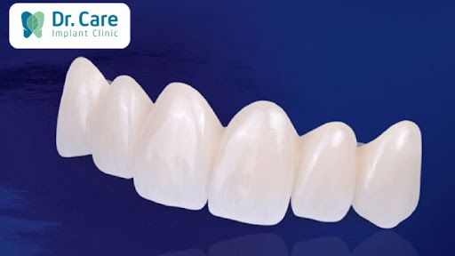 Răng sứ Đức Zirconia DDBio