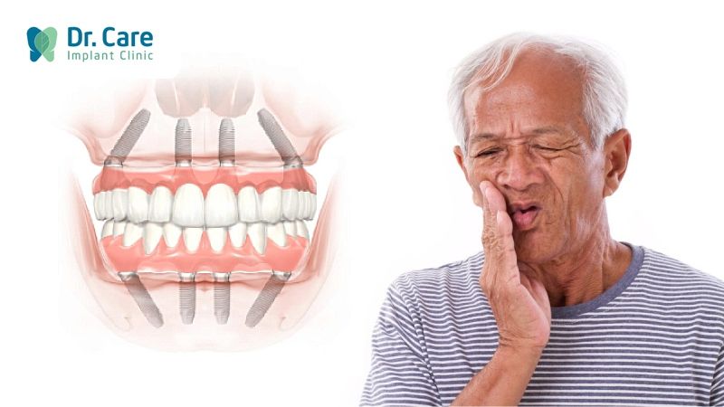 Hậu quả có thể xảy ra khi trồng Implant toàn hàm sai kỹ thuật 