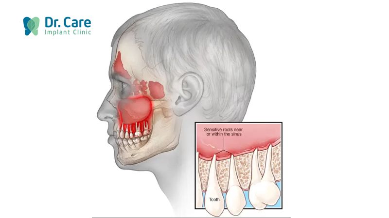 Mất răng toàn hàm ảnh hưởng đến hệ thần kinh