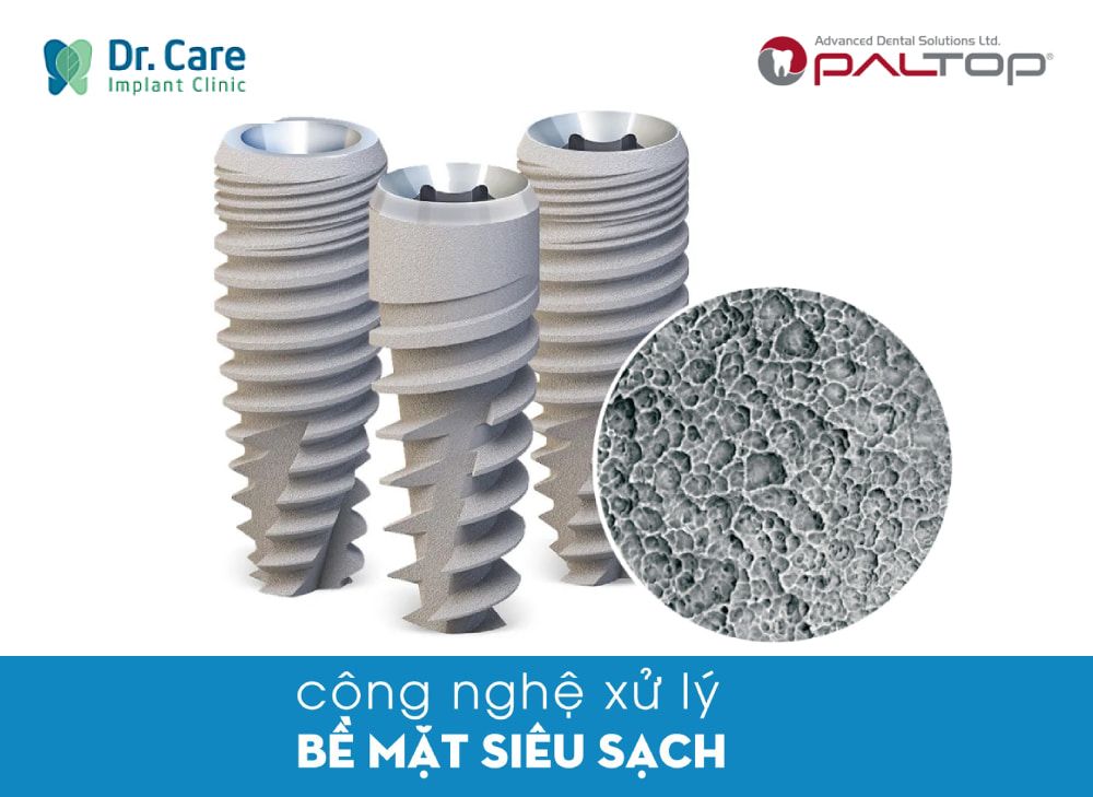 Cấu tạo trụ Implant Paltop