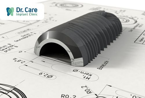 So sánh giá của trụ Implant SIC với các dòng trụ khác