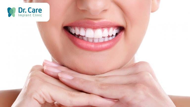 So sánh chi phí trụ Implant Hiossen với những dòng Implant Mỹ khác