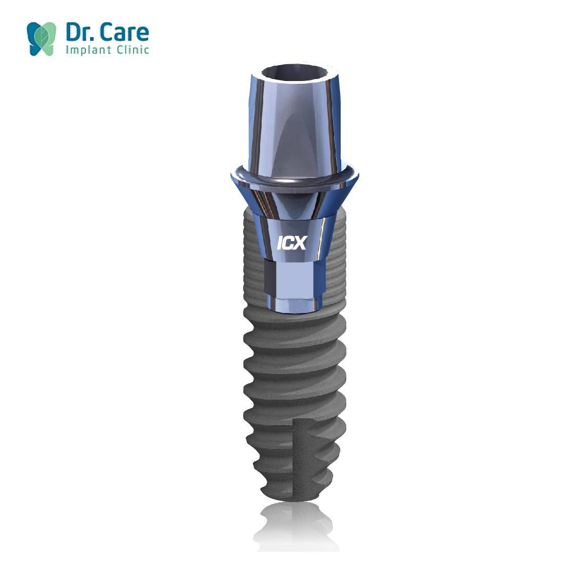 5 lý do trụ Implant ICX được nhiều người ưa chuộng