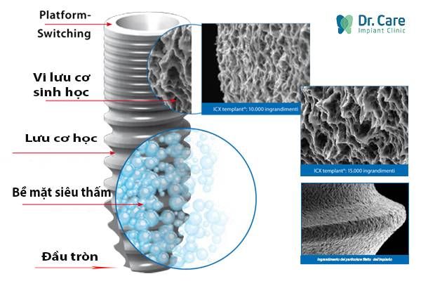 Cấu tạo trụ Implant ICX