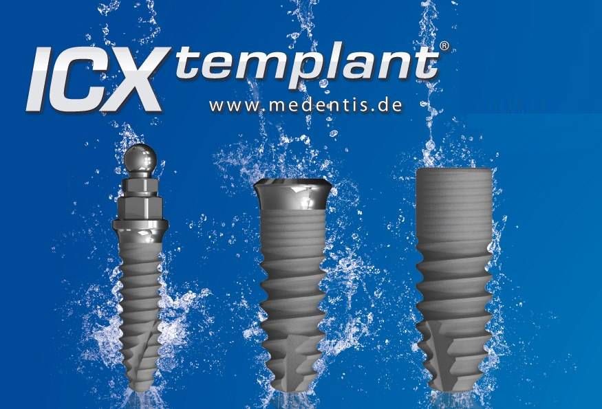 Xuất xứ trụ Implant ICX