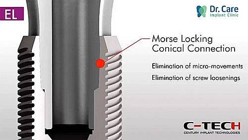 Cấu tạo trụ Implant C-Tech 