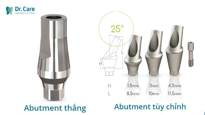 Có 2 loại khớp nối Abutment