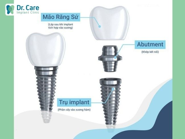 Mão răng sứ