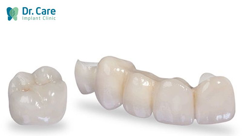 Chi phí răng sứ Zirconia như thế nào?