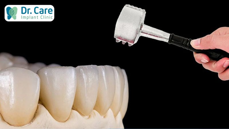 Ưu điểm khi bọc răng sứ Zirconia là gì?