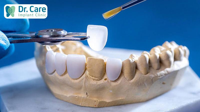 Phân loại răng sứ Zirconia