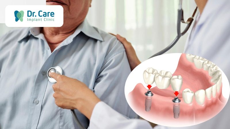 Vì sao người cao huyết áp nên thận trọng khi trồng răng Implant 