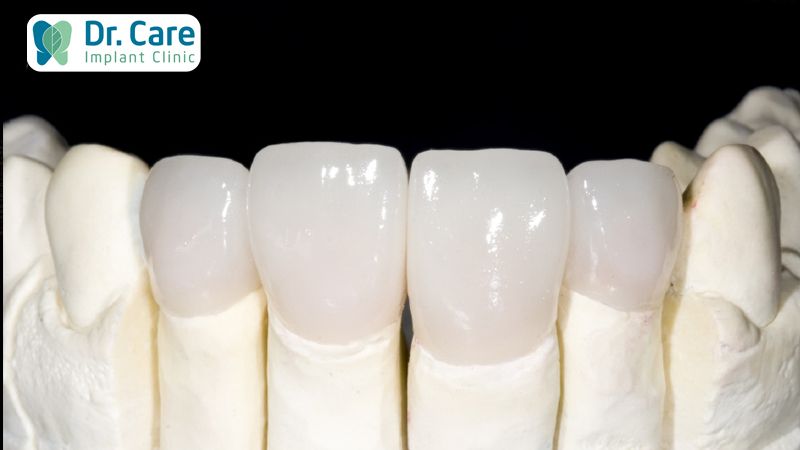 Nhược điểm của răng sứ Zirconia 