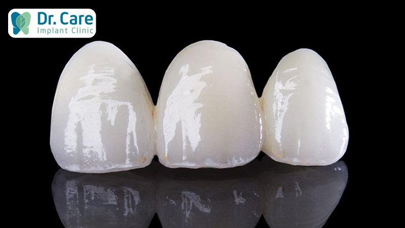 Cách nhận biết răng sứ Zirconia