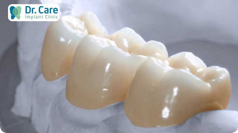 Răng sứ Zirconia là gì?