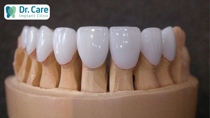 Chi phí của răng sứ Zirconia và răng sứ Titan tại Nha khoa uy tín?