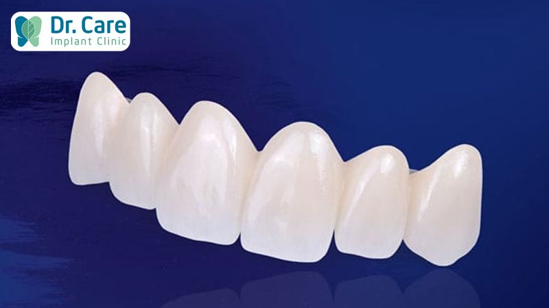 4. Quy Trình Bọc Răng Sứ Zirconia