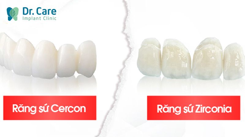 So sánh răng sứ Zirconia và Cercon