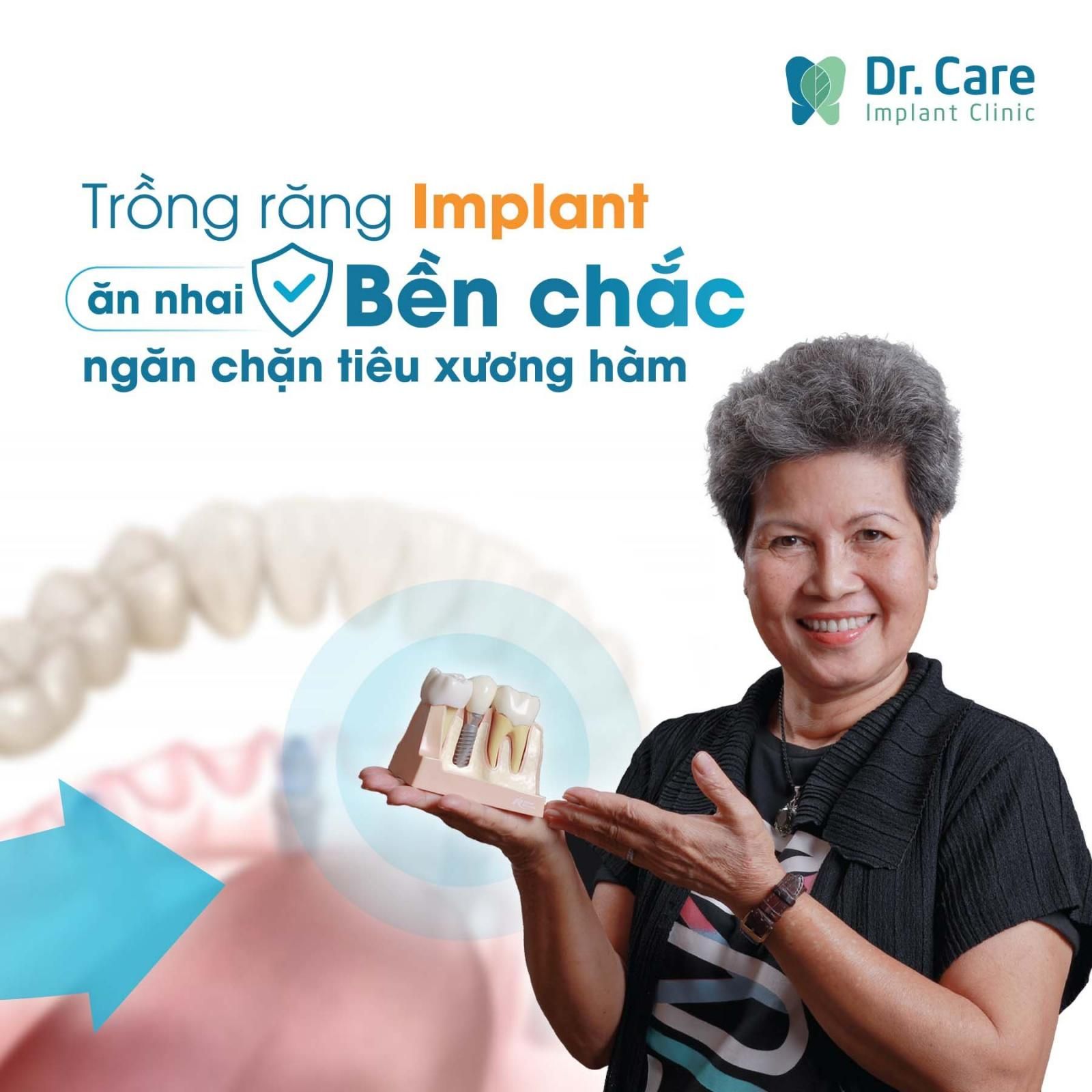 Trồng răng Implant - phương pháp trồng răng giả tốt nhất