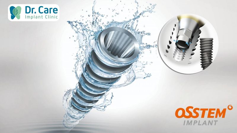 Trụ Implant Hàn Quốc có được bảo hành không? 