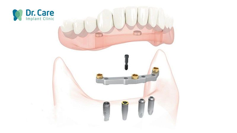 Bước 3: Thử và gắn hàm phủ chính thức