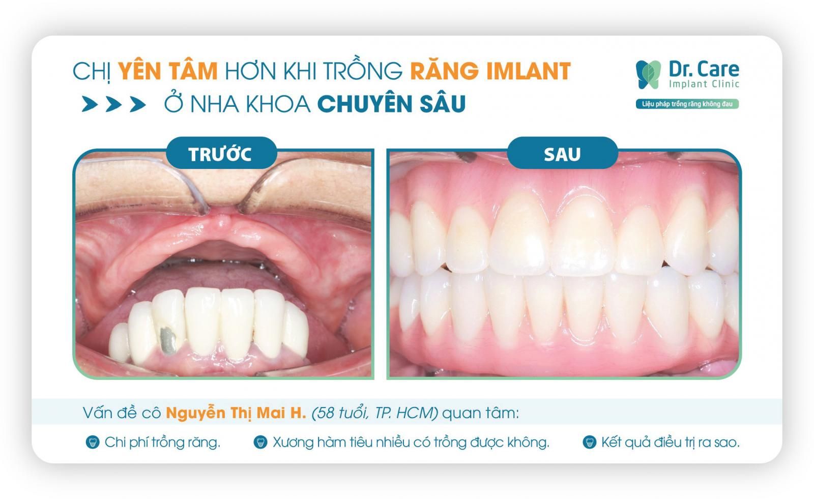 Độ bền chắc vượt trội