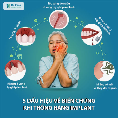 Sưng đau kéo dài trong nhiều ngày